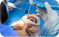 The Benefits of Professional Teeth Whitening