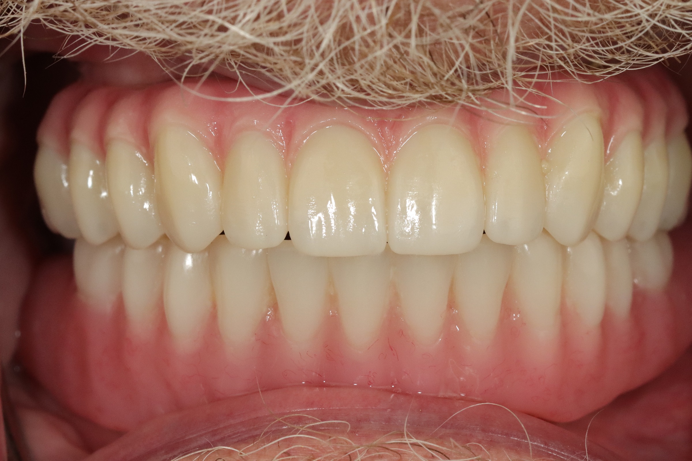 Before image