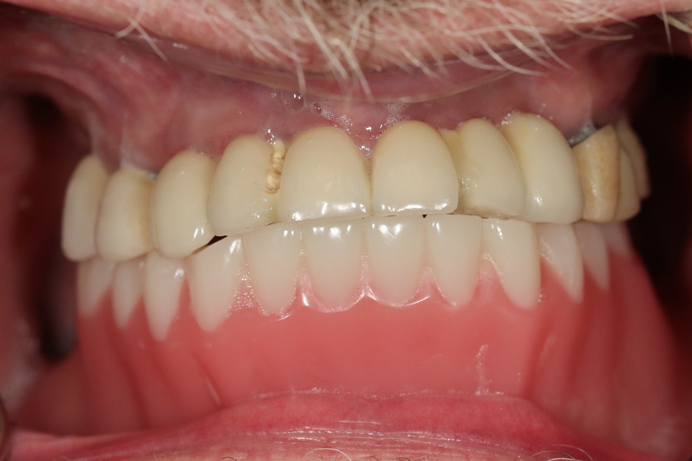 After image