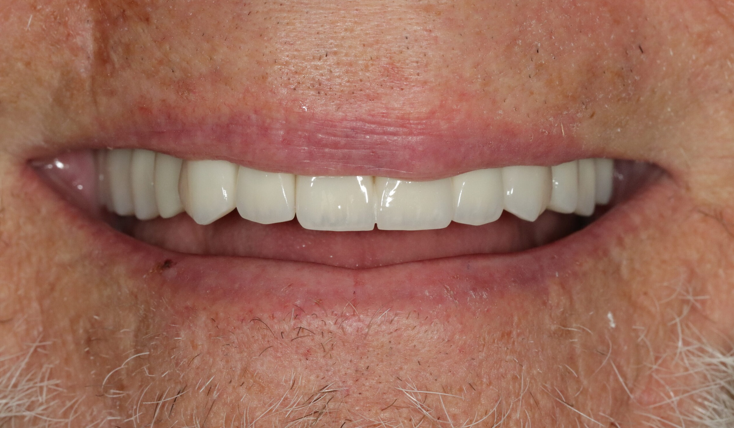 Before image