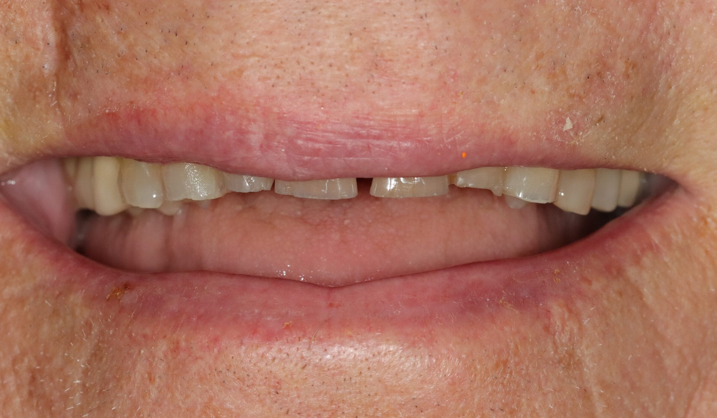 After image