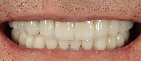 Before image