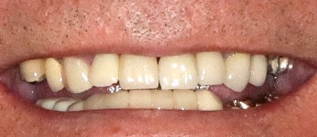 After image