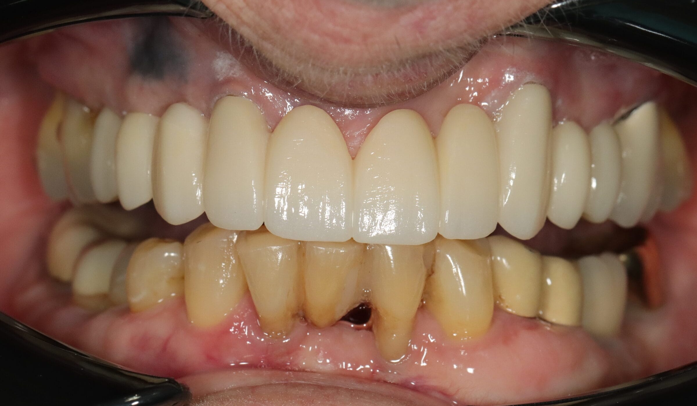 Before image