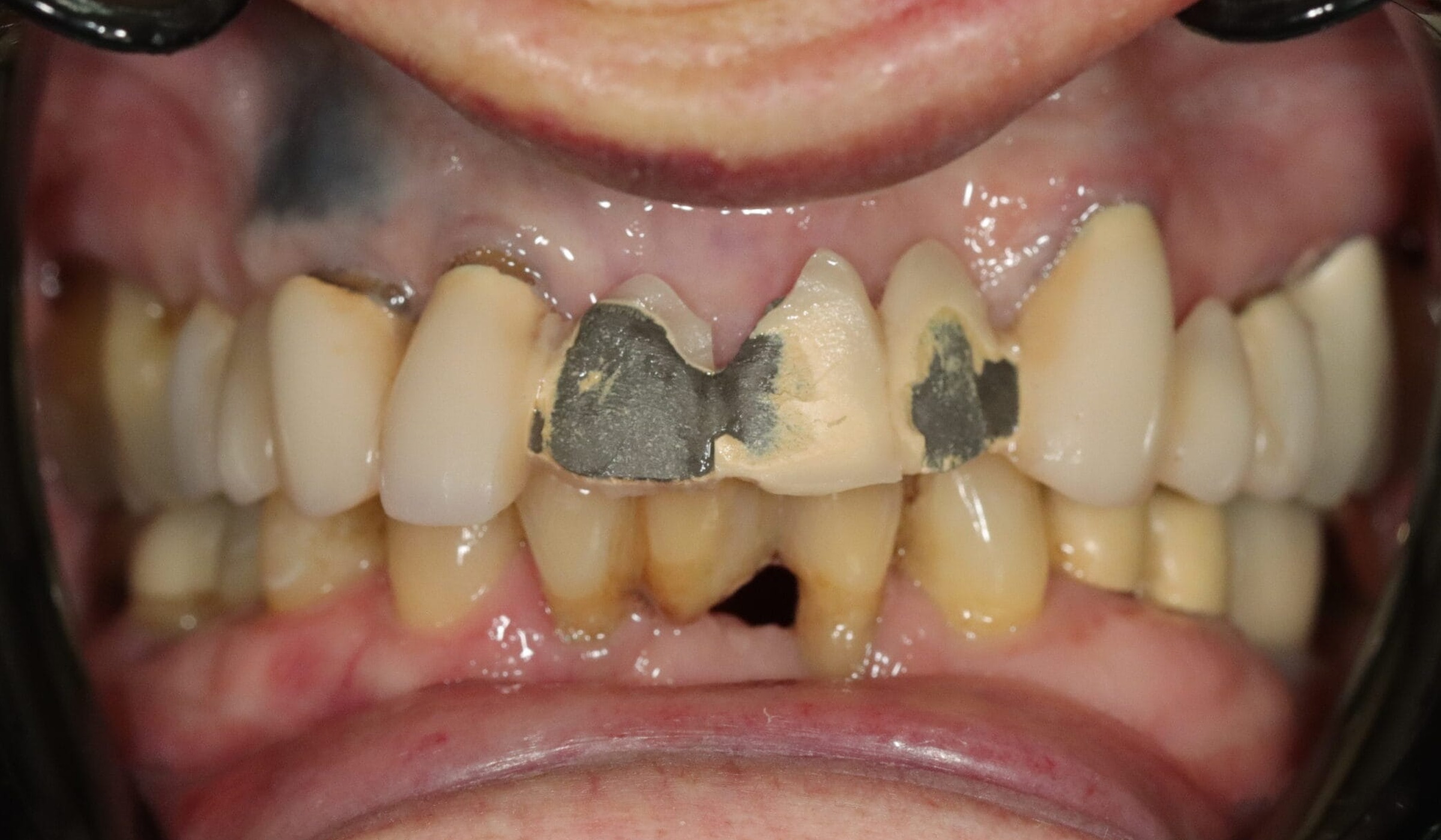 After image