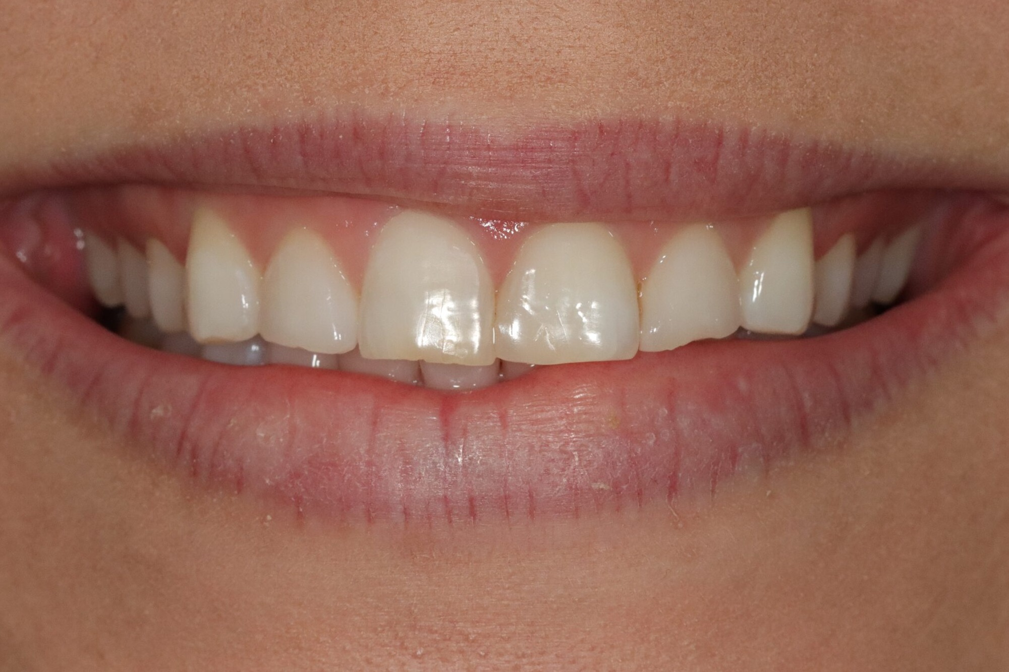 After image