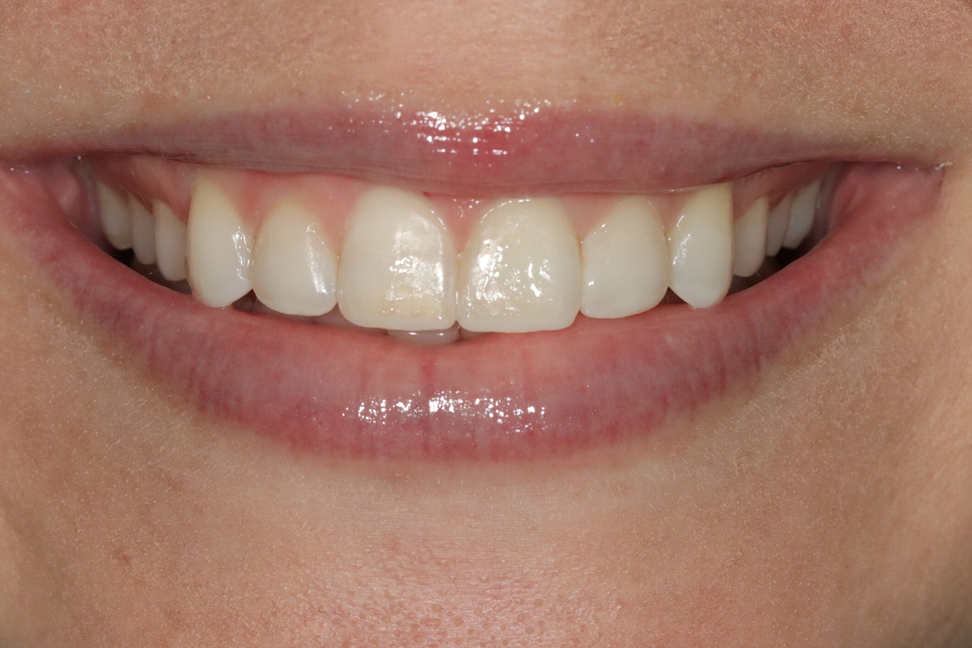 Before image