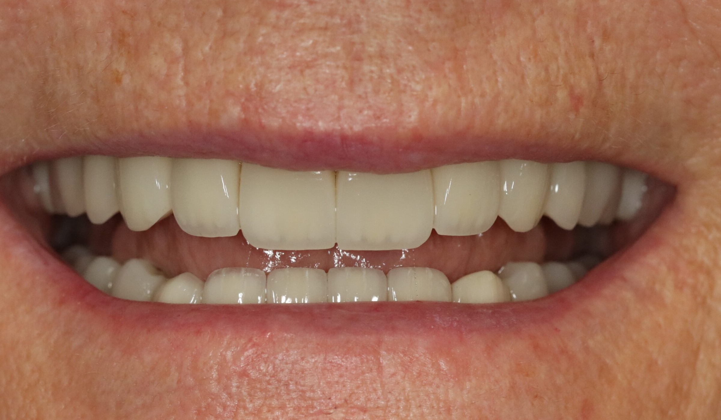 Before image