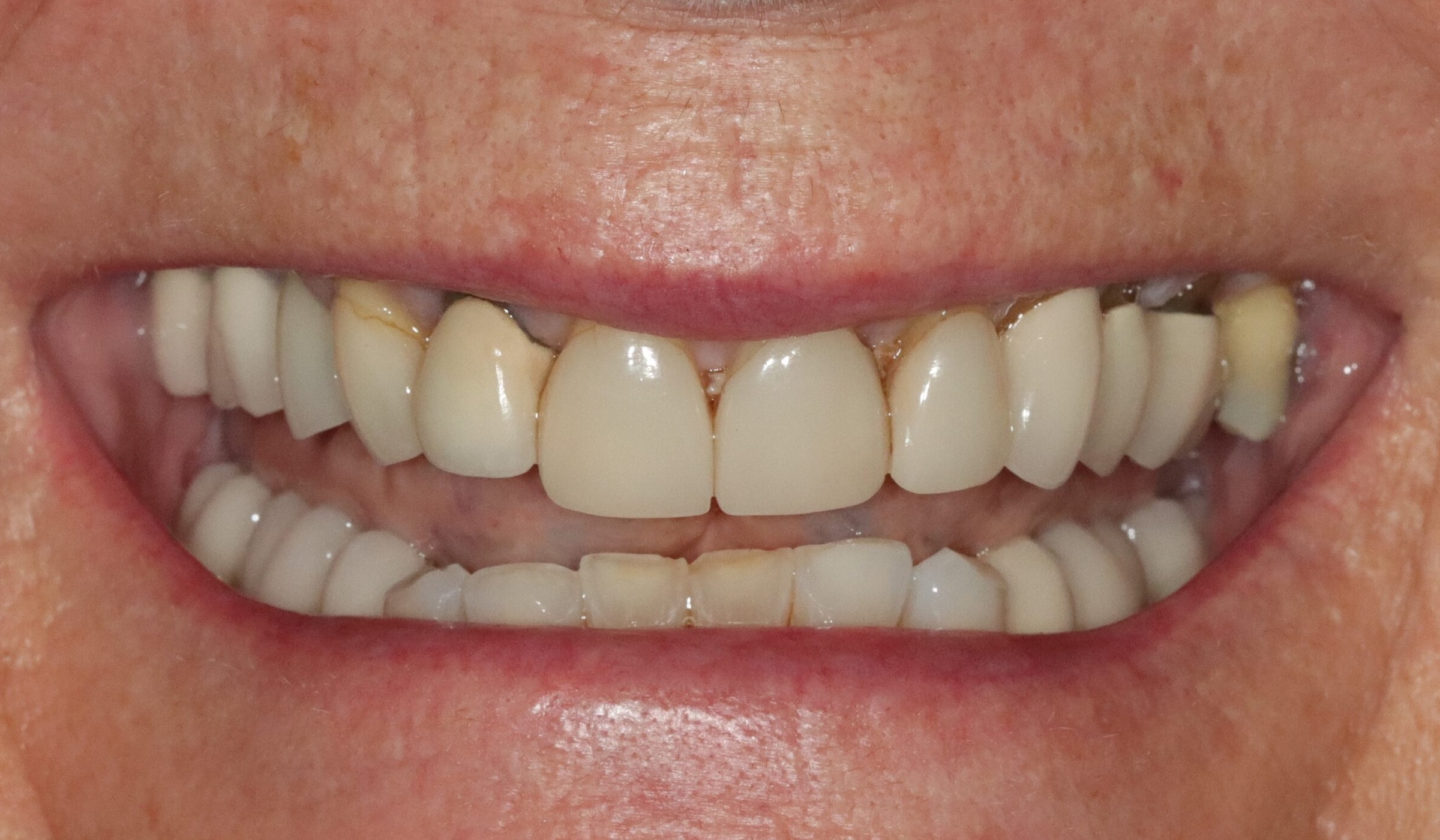 After image