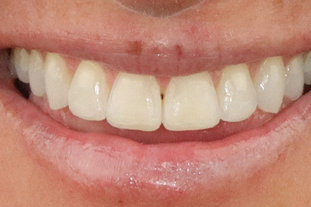 Before image