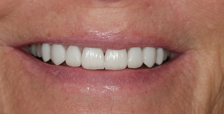 Before image