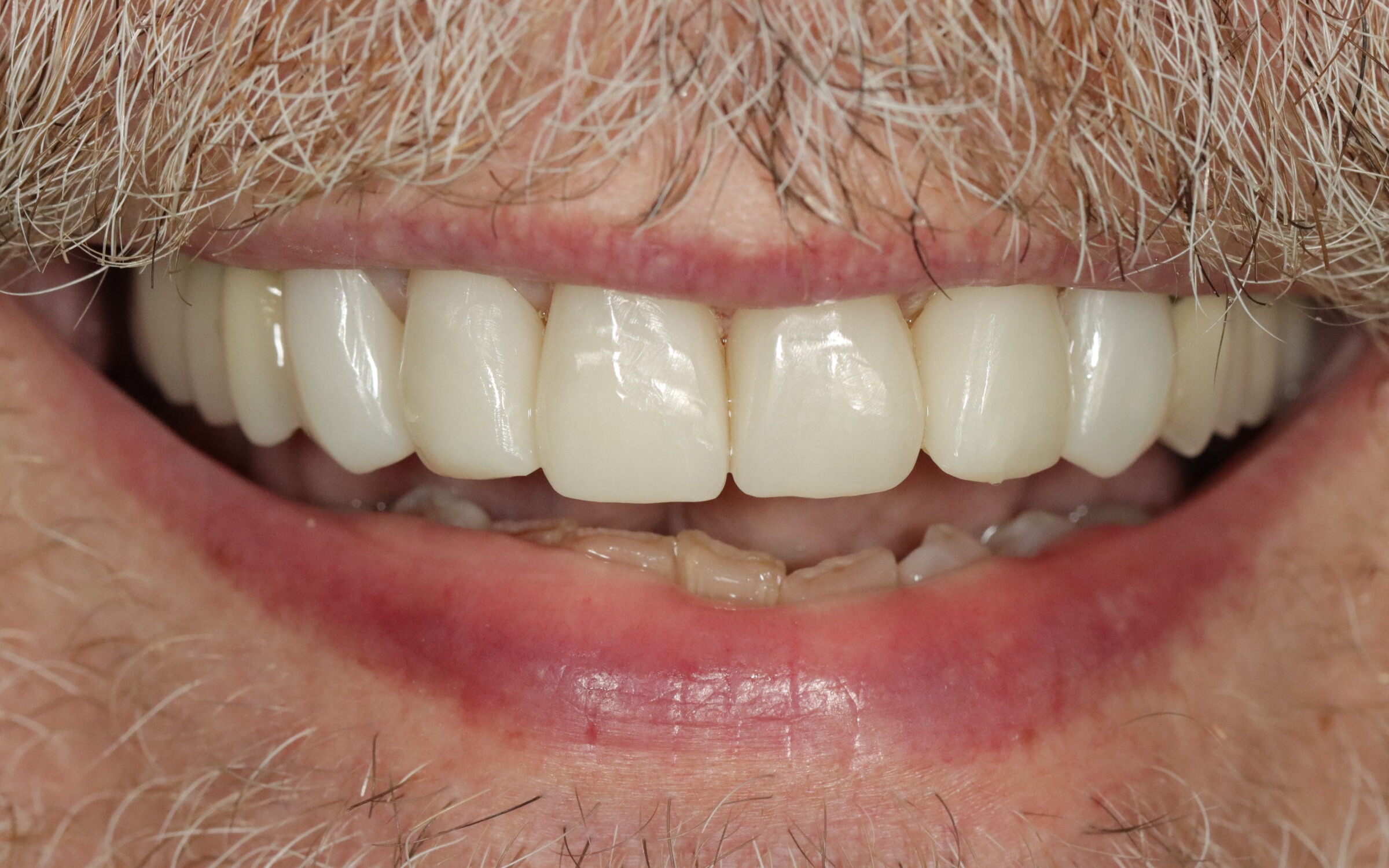 Before image