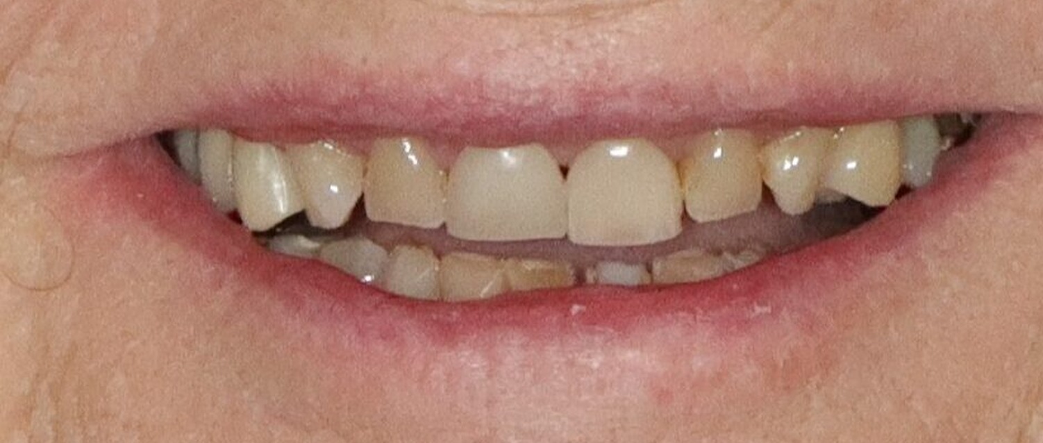 After image