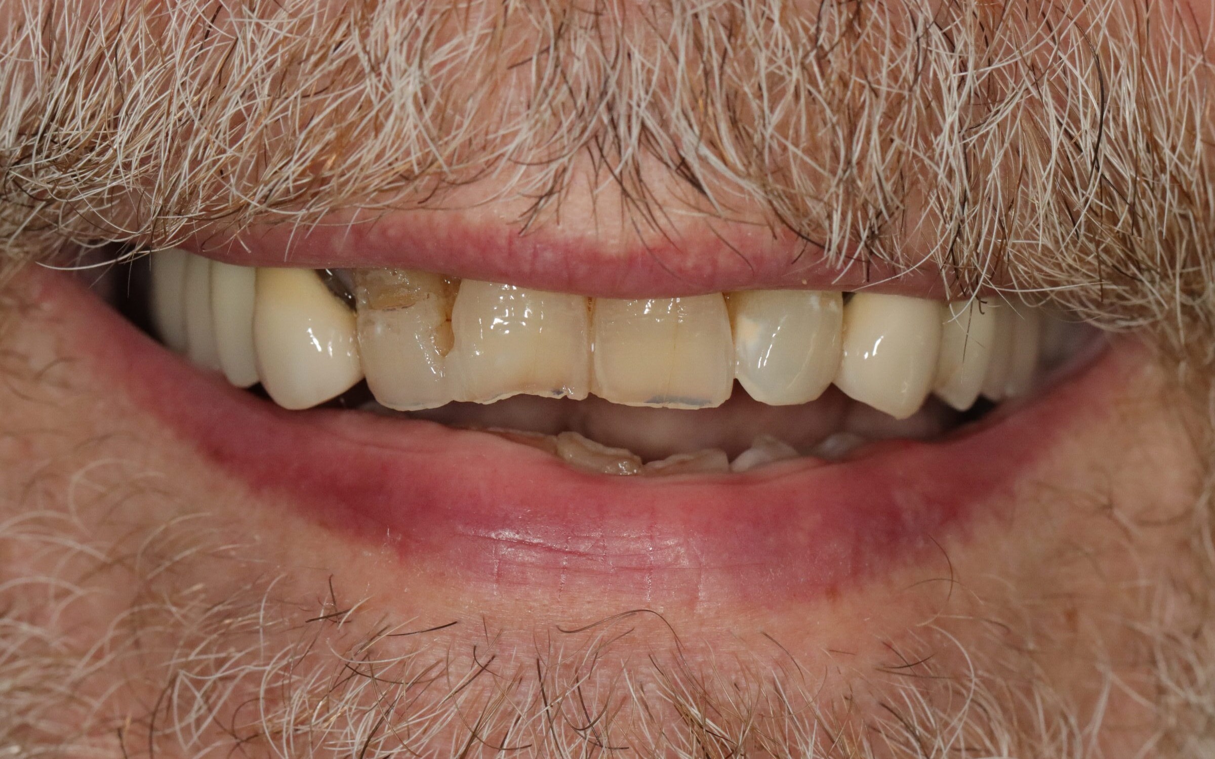 After image