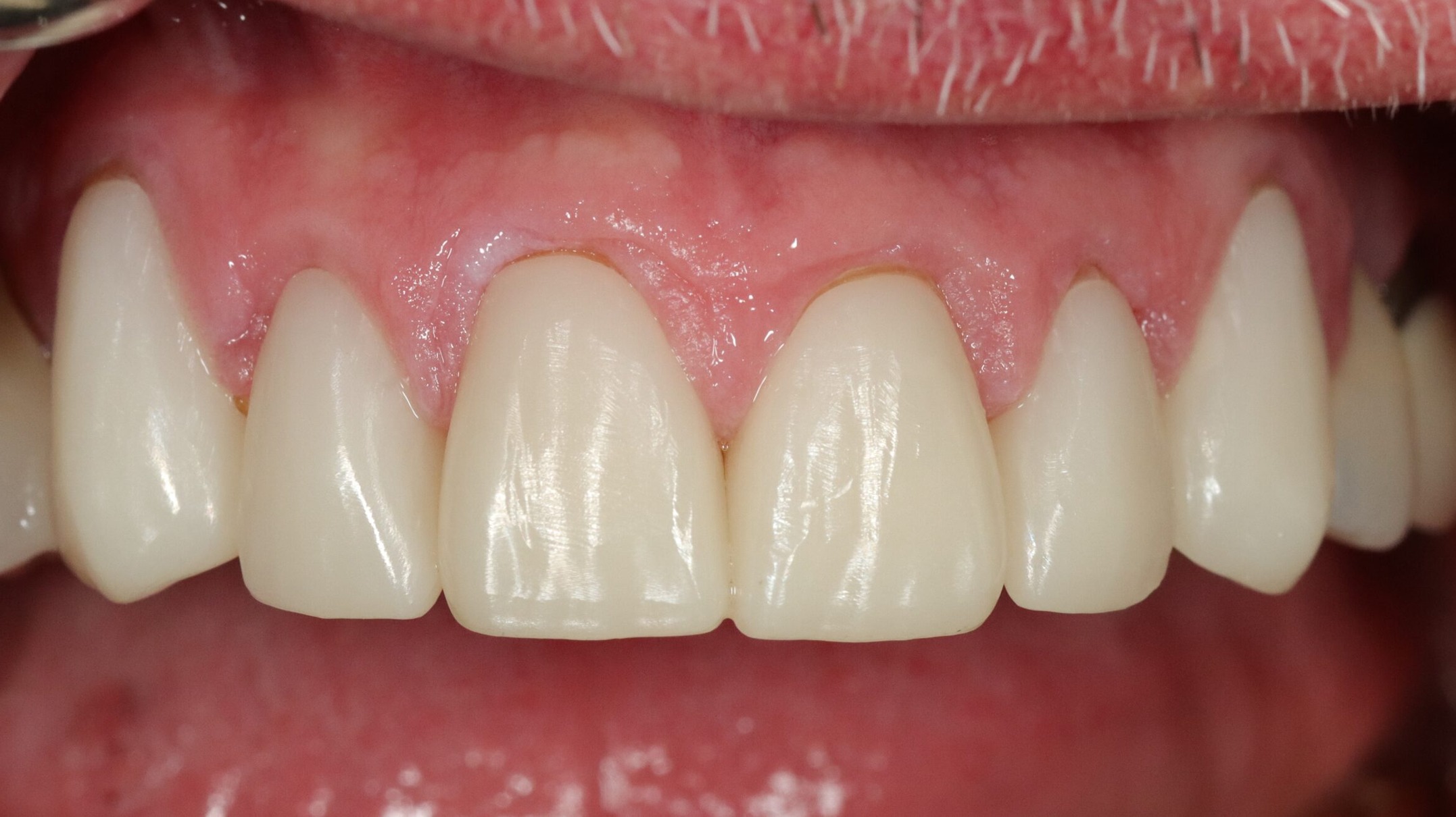 Before image