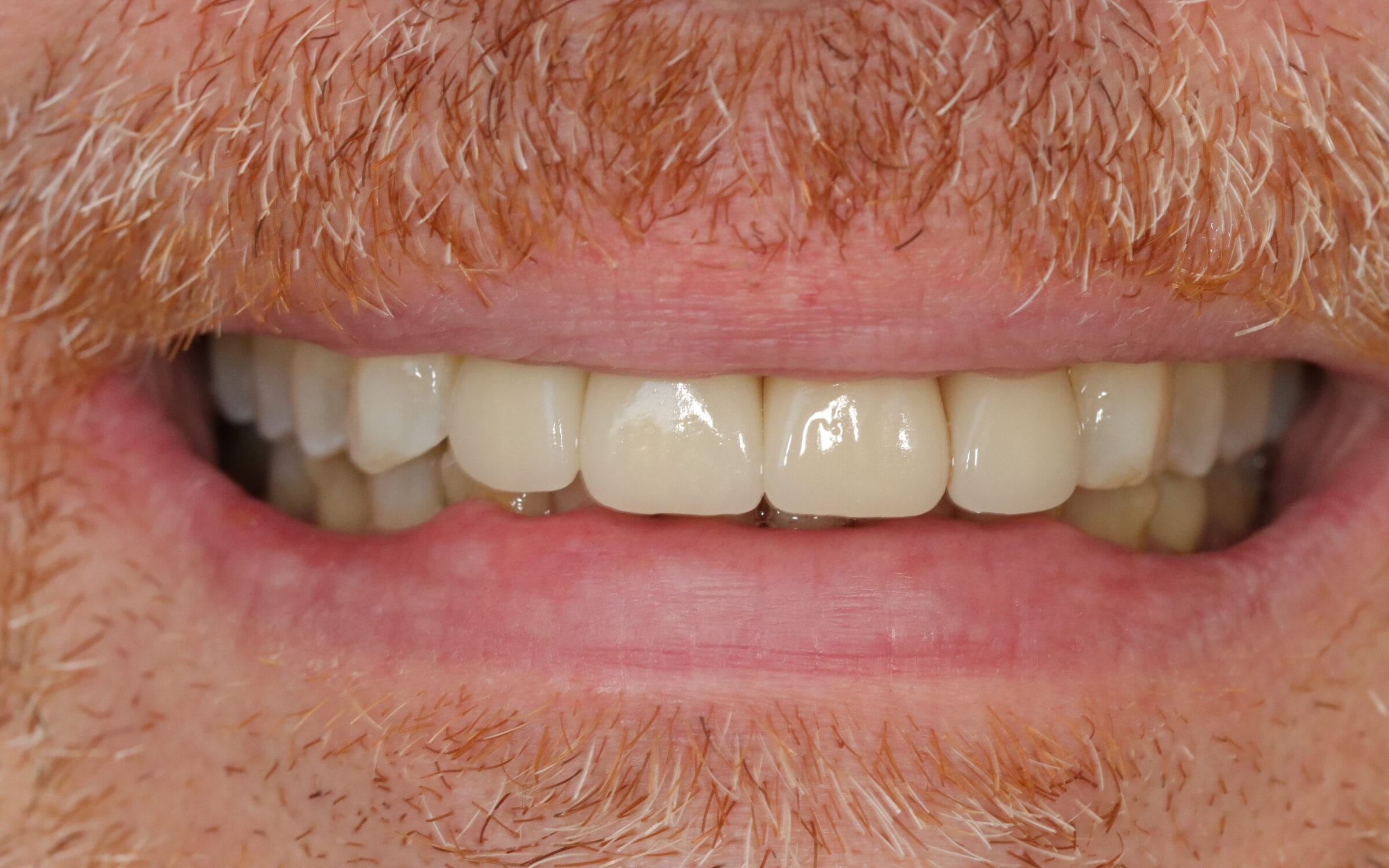 Before image