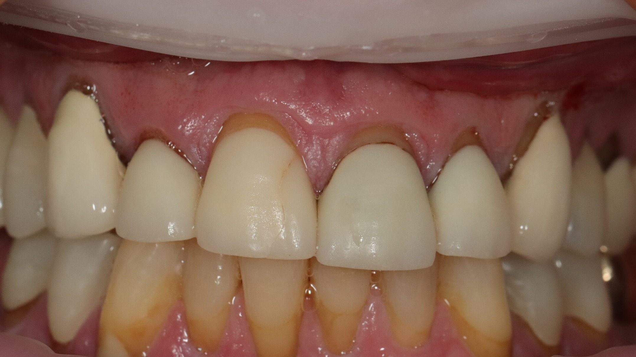 After image