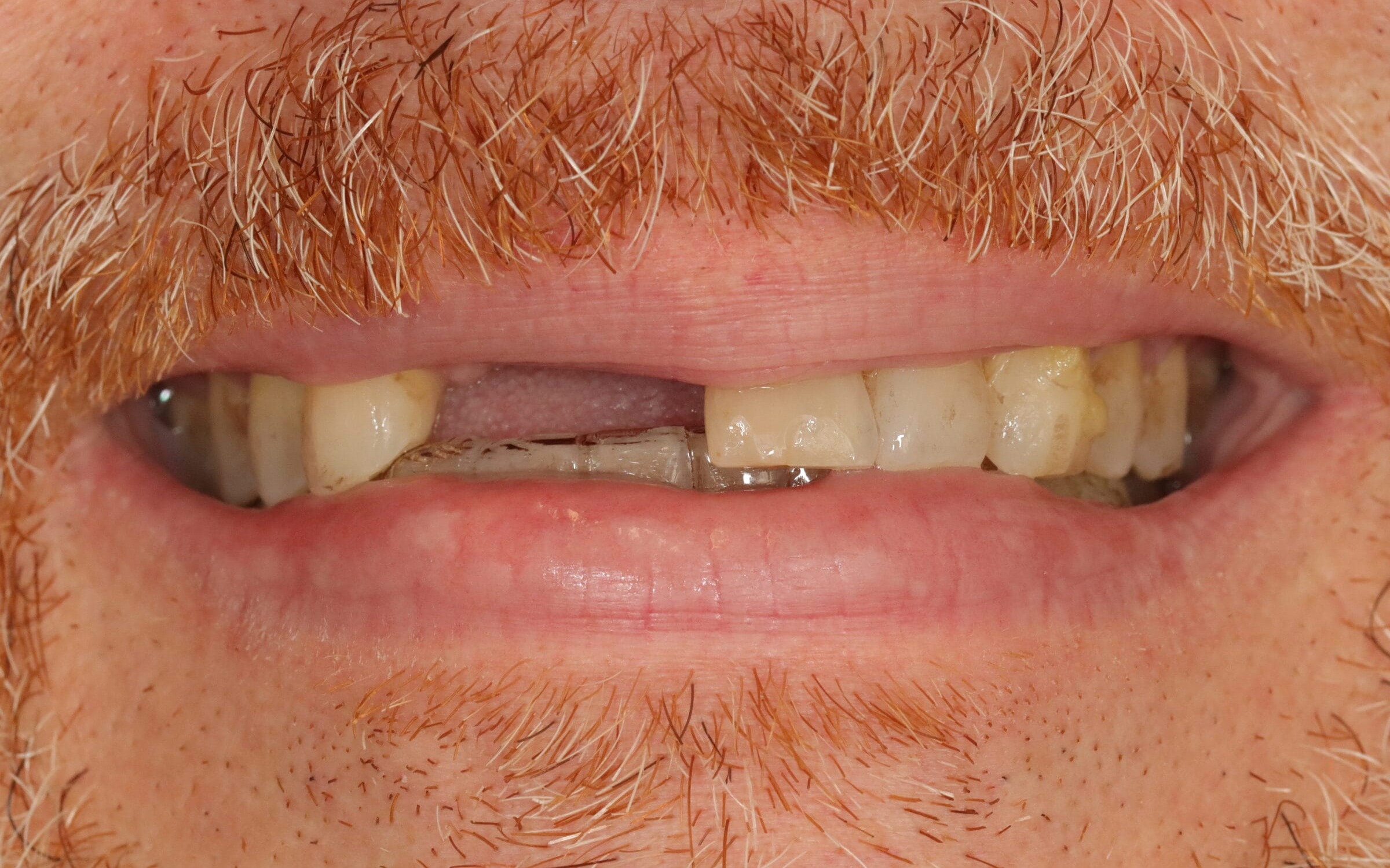 After image