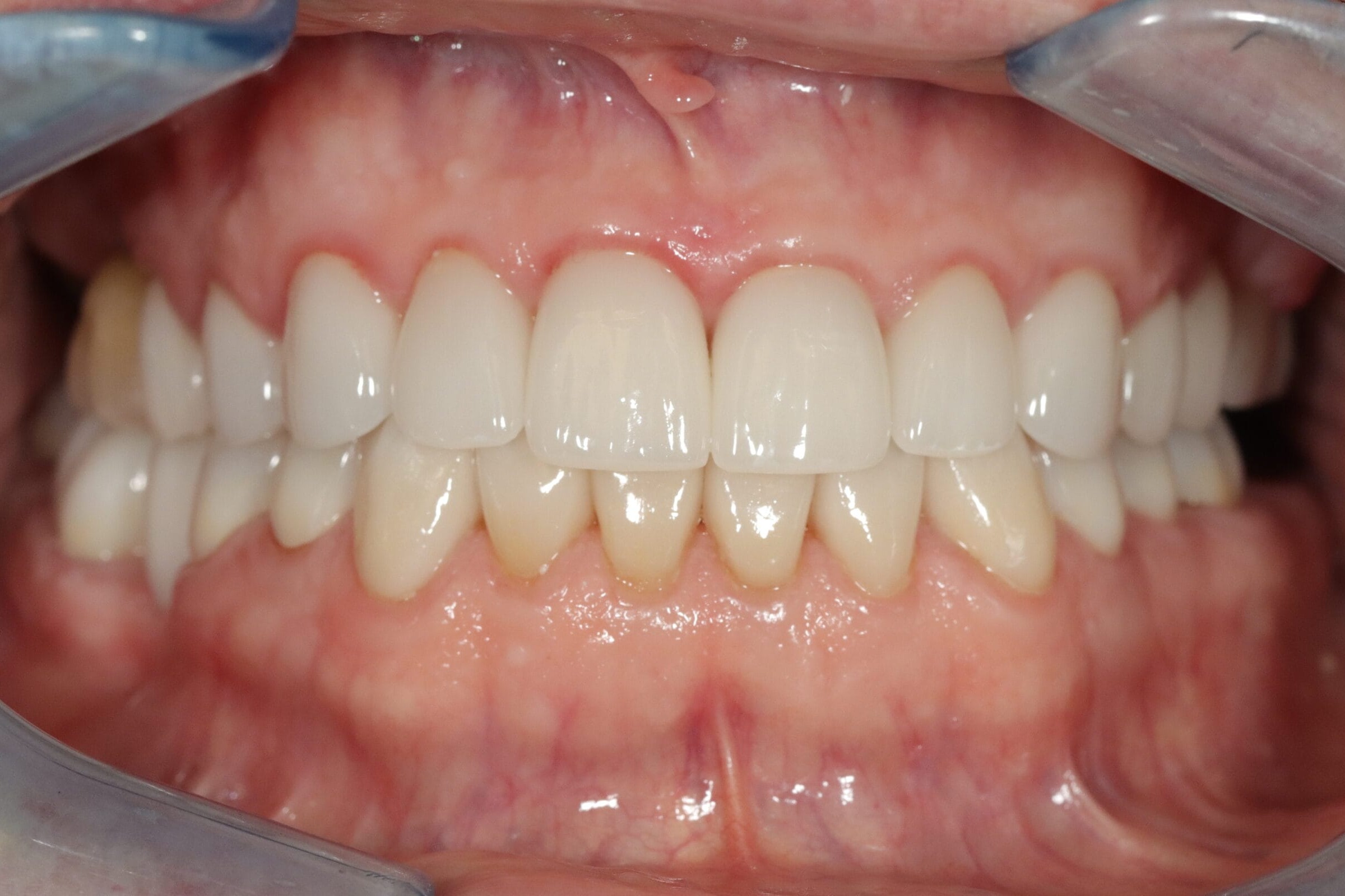 Before image