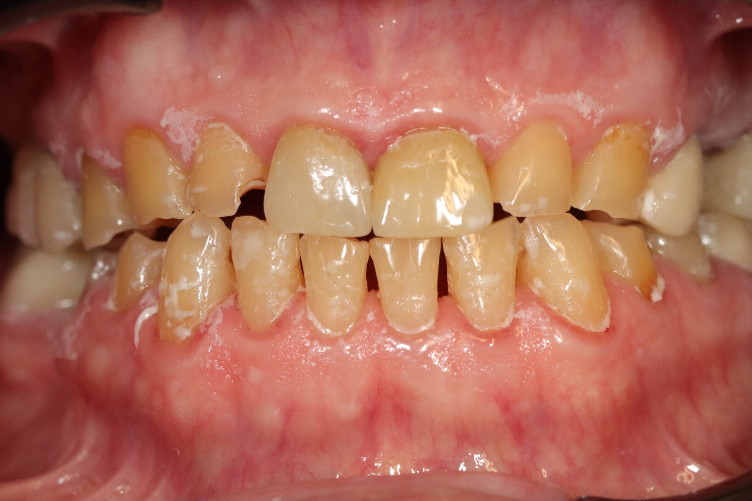 After image