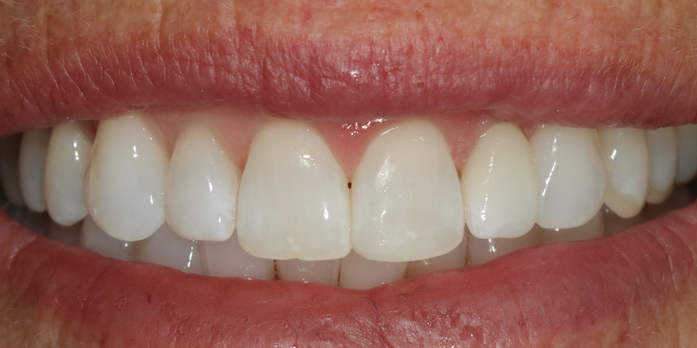 Before image