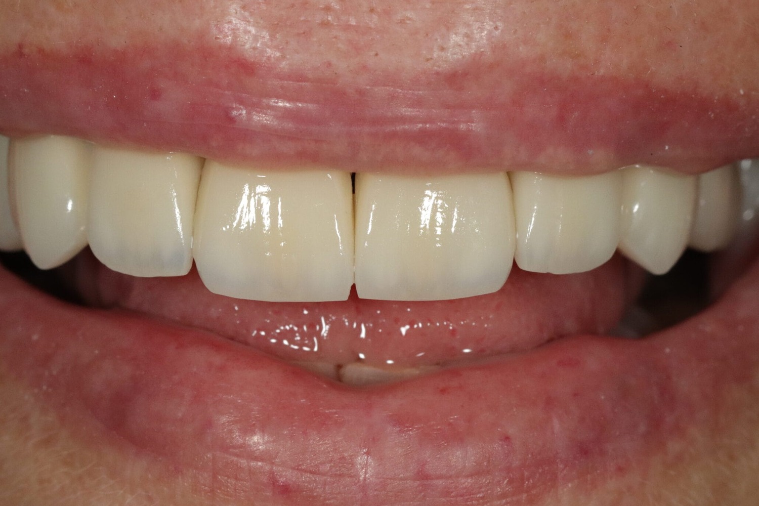 Before image