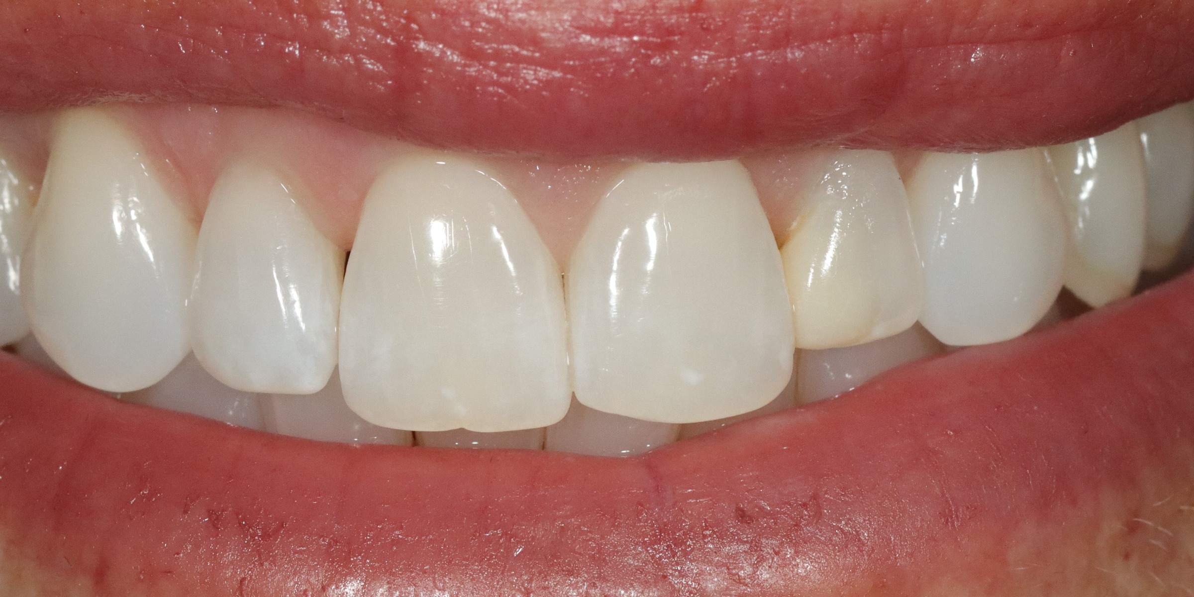 After image