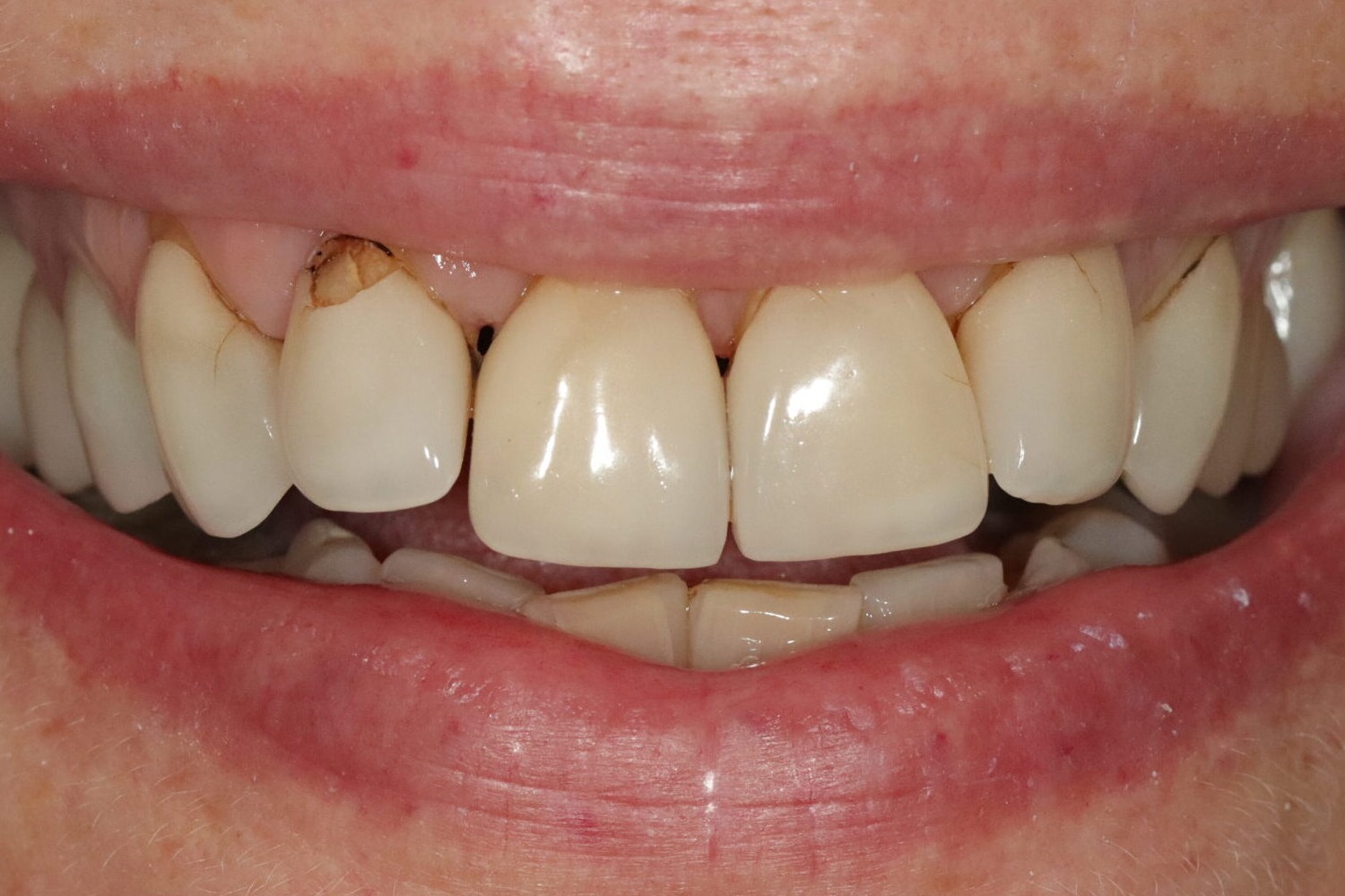 After image