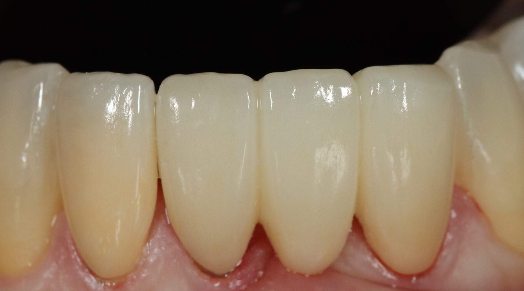 Before image