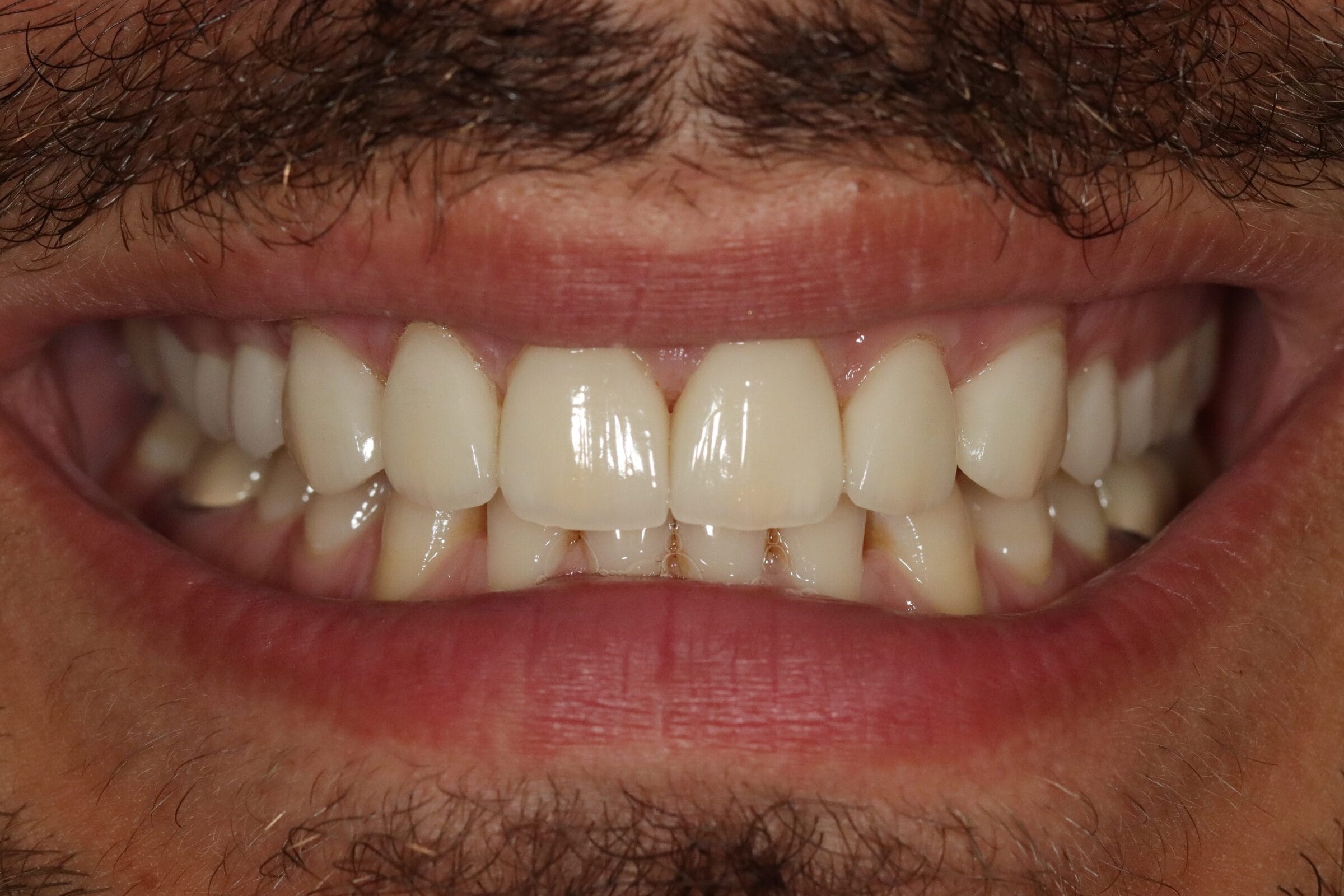 Before image