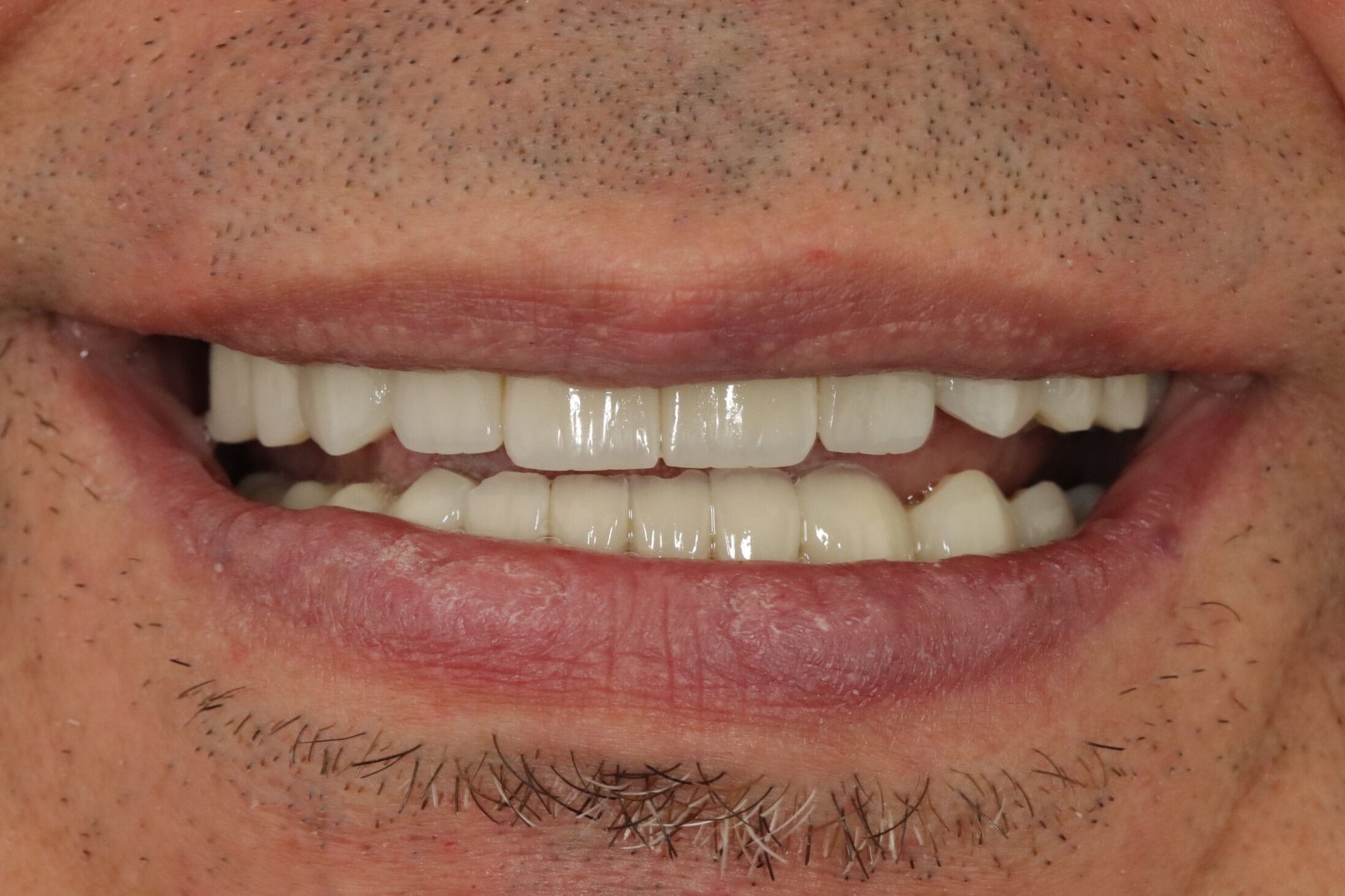 Before image