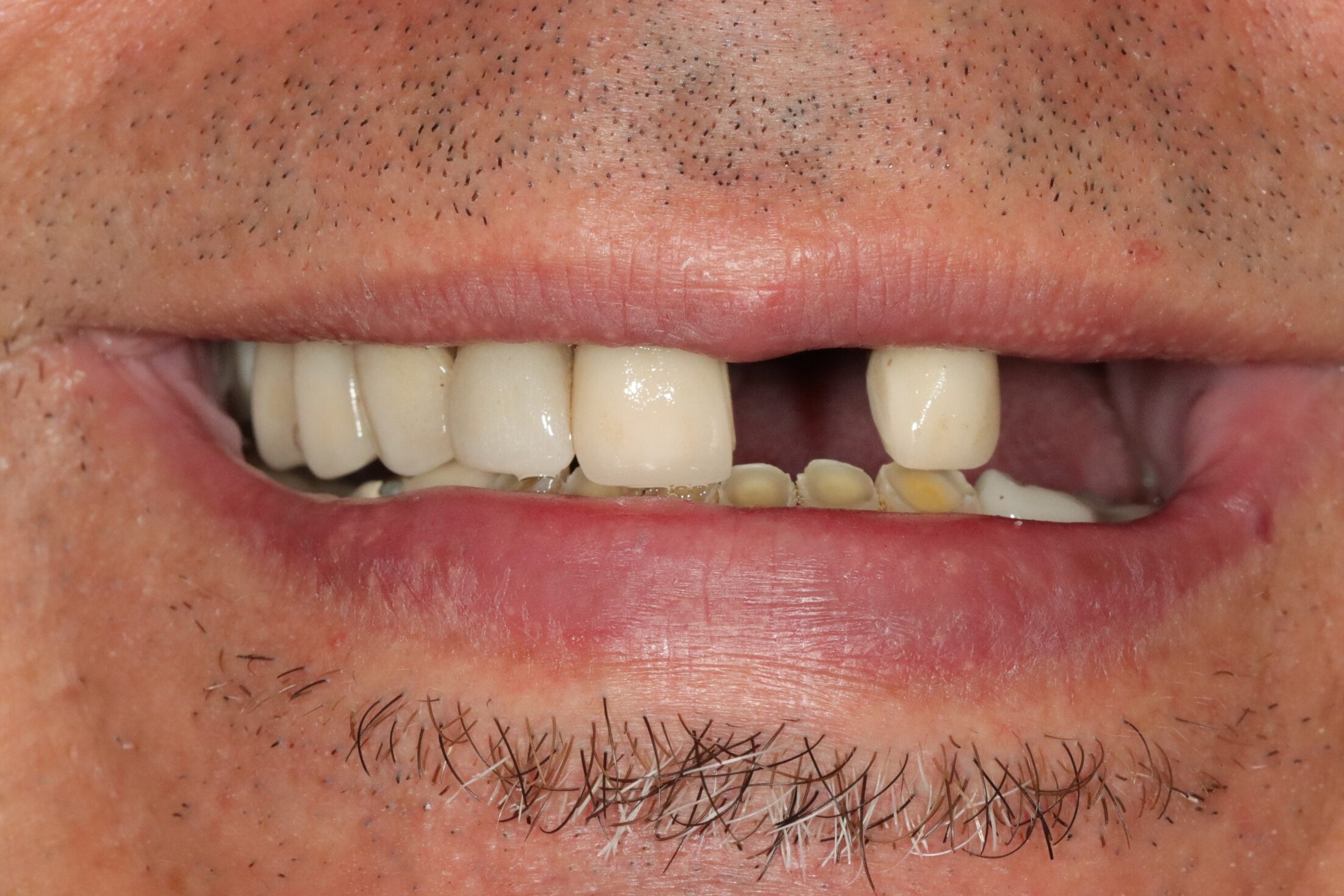 After image